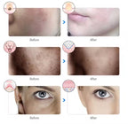 Rechargeable Facial LED Mask 7 Colors LED Photon Beauty Mask Skin Rejuvenation Home Face Lifting Whitening Skin Care Beauty Mask